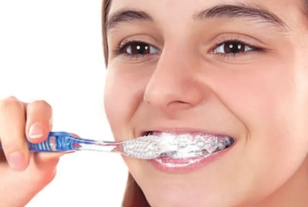 How to avoid Tooth Cavities with Dental Braces