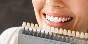 Teeth Whitening in Goa